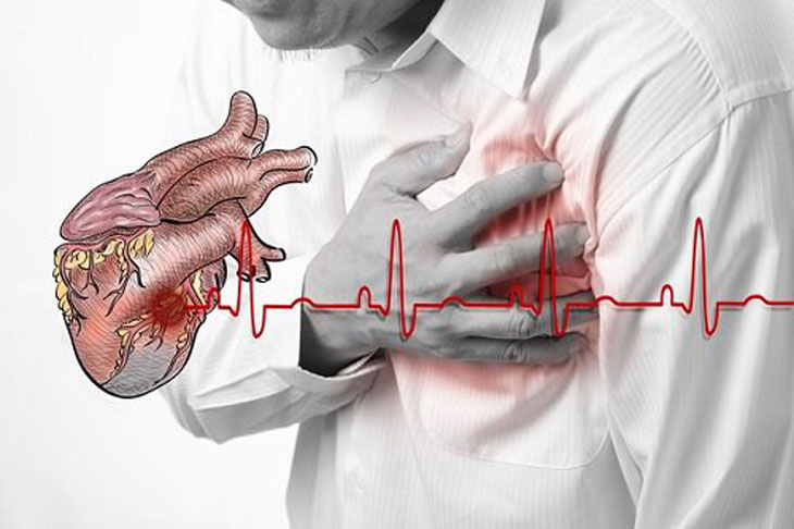 Bụi PM2.5 đẩy nhanh quá trình Apoptosis làm tăng nguy cơ tử vong ở bệnh tim mạch