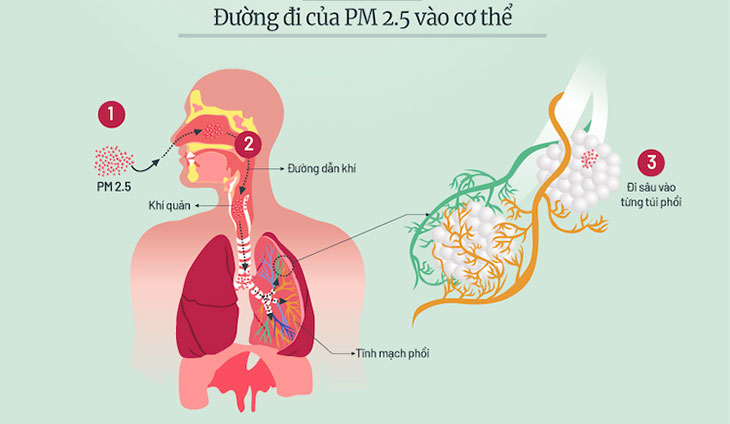 Bụi mịn PM2.5 mang đến những con vi khuẩn có hại cho cơ thể bạn