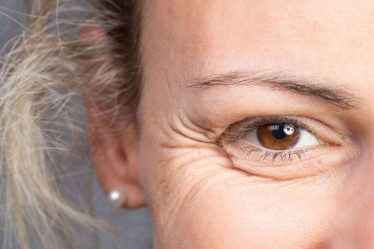 dấu hiệu lão hoá vùng da mắt