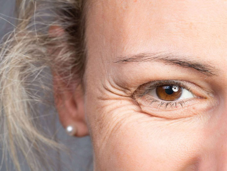 dấu hiệu lão hoá vùng da mắt