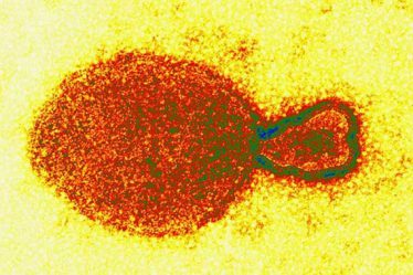 Hình ảnh hiển vi điện tử của virus HeV thuộc chi Henipavirus. Ảnh: Australian Animal Health Laboratory