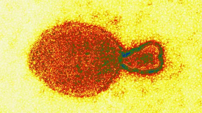 Hình ảnh hiển vi điện tử của virus HeV thuộc chi Henipavirus. Ảnh: Australian Animal Health Laboratory
